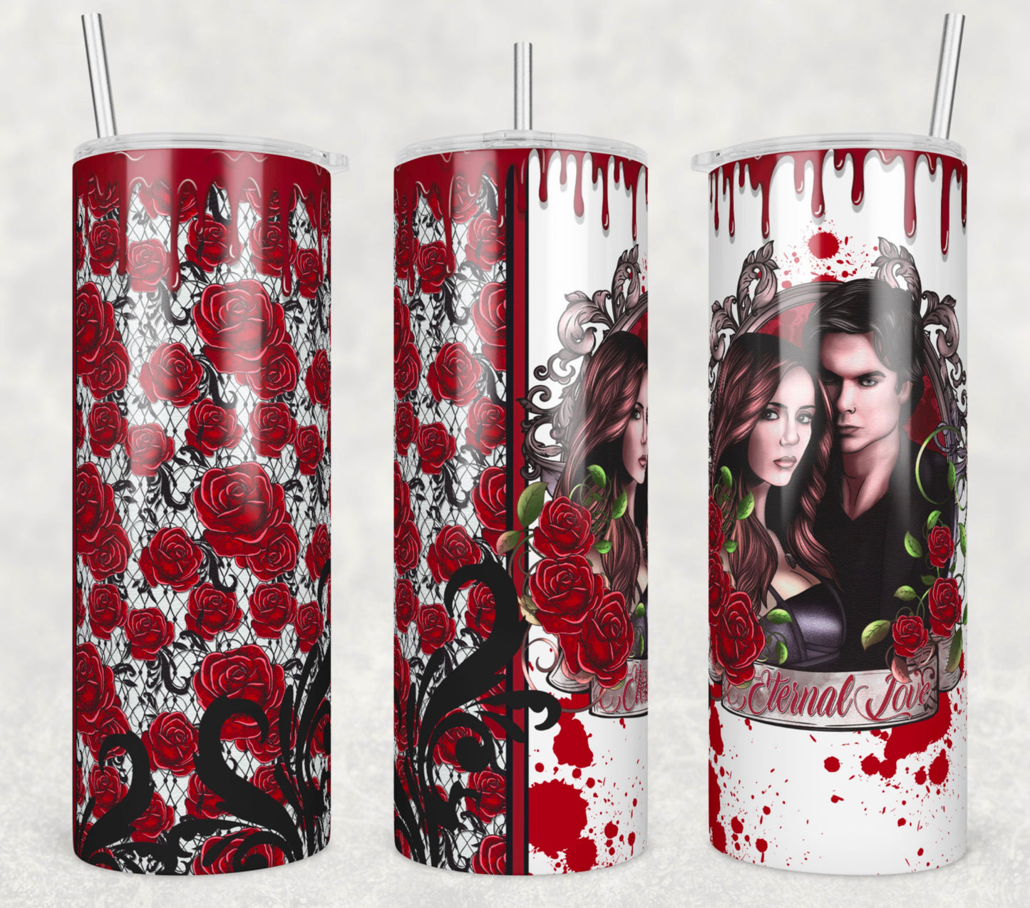 TVD